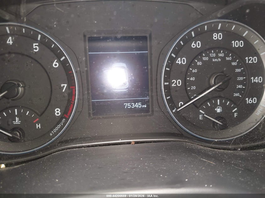 2021 Hyundai Kona VIN KM8K1CAA2MU602097 IAAI salvage auction — RIGHT SIDE, Salvage Title, sold $25 on 2026-07-21 (photo 7)