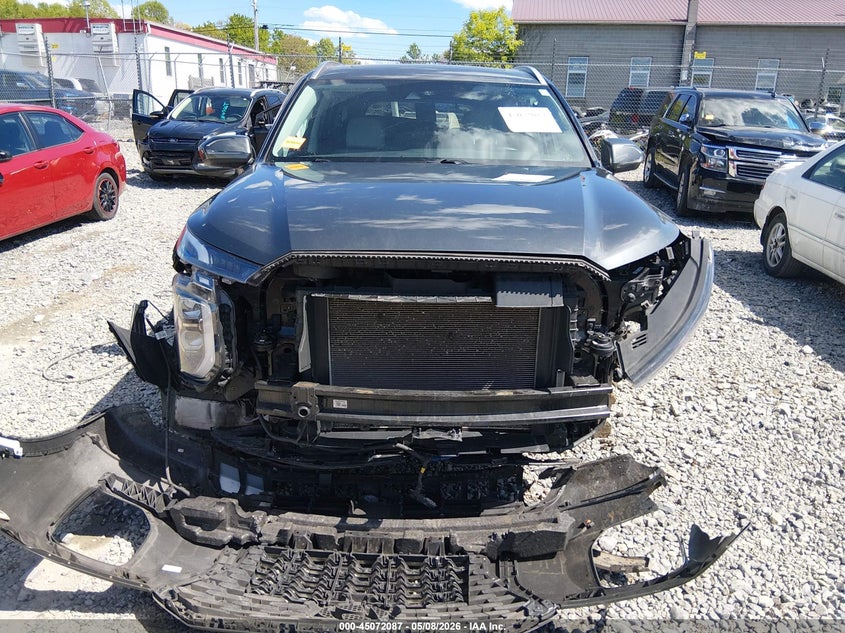 2021 Hyundai Palisade VIN KM8R4DHE0MU264199 IAAI salvage auction — FRONT END, Salvage (West Virginia), sold $3,450 on 2026-07-15 (photo 6)