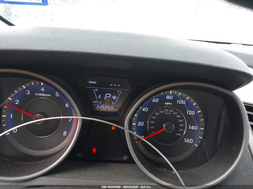 2014 Hyundai Elantra VIN KMHDH4AE0EU199431 IAAI salvage auction — RIGHT SIDE, Salvage (Texas), sold $975 on 2026-07-28 (photo 7)