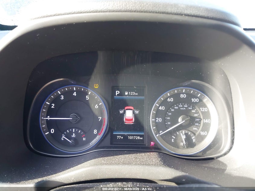 2020 Hyundai Kona VIN KM8K62AA7LU542084 IAAI salvage auction — Right Side, Non-Repairable, sold $3,000 on 2026-10-19 (photo 7)