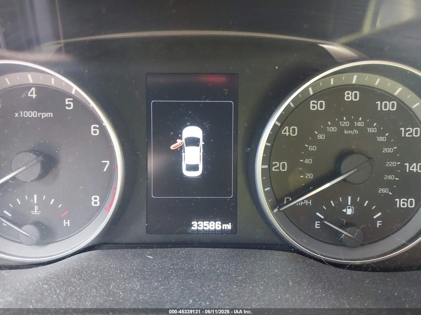 2017 Hyundai Elantra VIN KMHD84LF9HU284259 IAAI salvage auction — FRONT END, Salvage (Rhode Island), sold $1,550 on 2026-07-25 (photo 7)