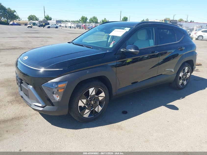 2025 Hyundai Kona VIN KM8HB3AB8SU332774 IAAI salvage auction — RIGHT SIDE, Salvage (California), sold $9,000 on 2026-07-08 (photo 2)