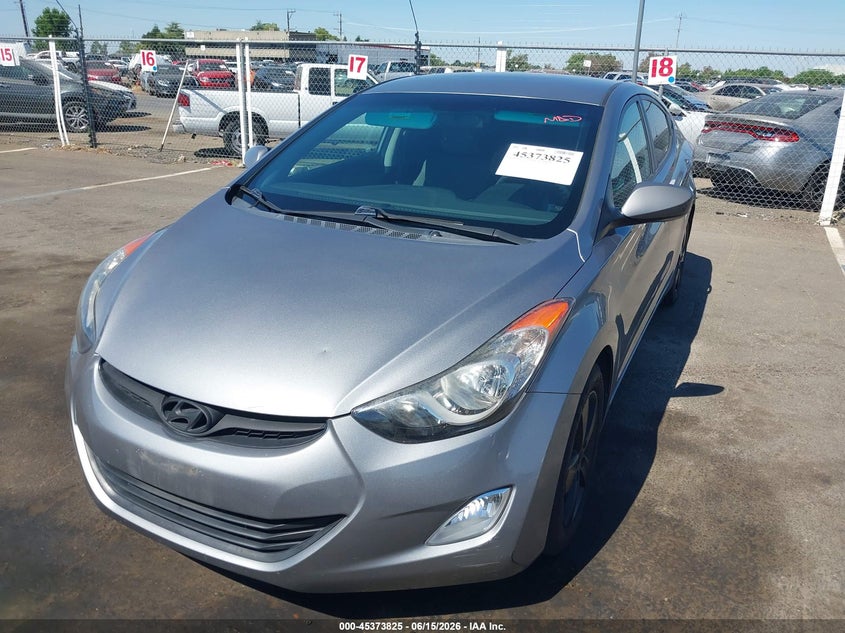 2012 Hyundai Elantra VIN KMHDH4AE4CU362109 IAAI salvage auction — LEFT SIDE, Salvage Title, sold $1,400 on 2026-07-29 (photo 2)