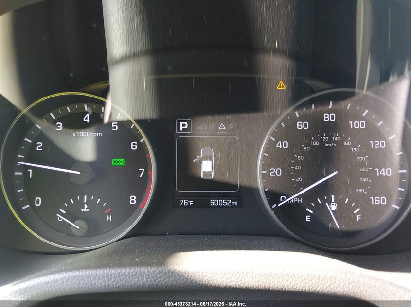 2018 Hyundai Elantra VIN KMHD84LFXJU590005 IAAI salvage auction — FRONT END, Salvage (Missouri), sold $1,950 on 2026-07-29 (photo 7)