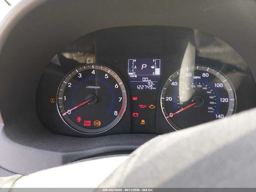 2017 Hyundai Accent VIN KMHCT4AE0HU193384 IAAI salvage auction — NORMAL WEAR, Clear (Kansas), sold $750 on 2026-07-22 (photo 7)