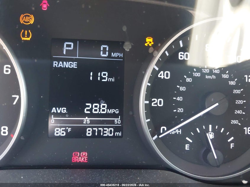 2017 Hyundai Elantra VIN KMHD74LFXHU398595 IAAI salvage auction — FRONT END, Salvage (California), sold $2,000 on 2026-07-06 (photo 7)