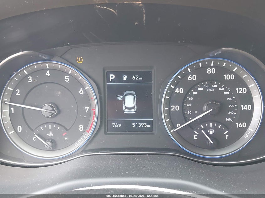 2021 Hyundai Kona VIN KM8K1CAA5MU609867 IAAI salvage auction — RIGHT SIDE, Salvage (Ohio), sold $3,150 on 2026-07-29 (photo 7)