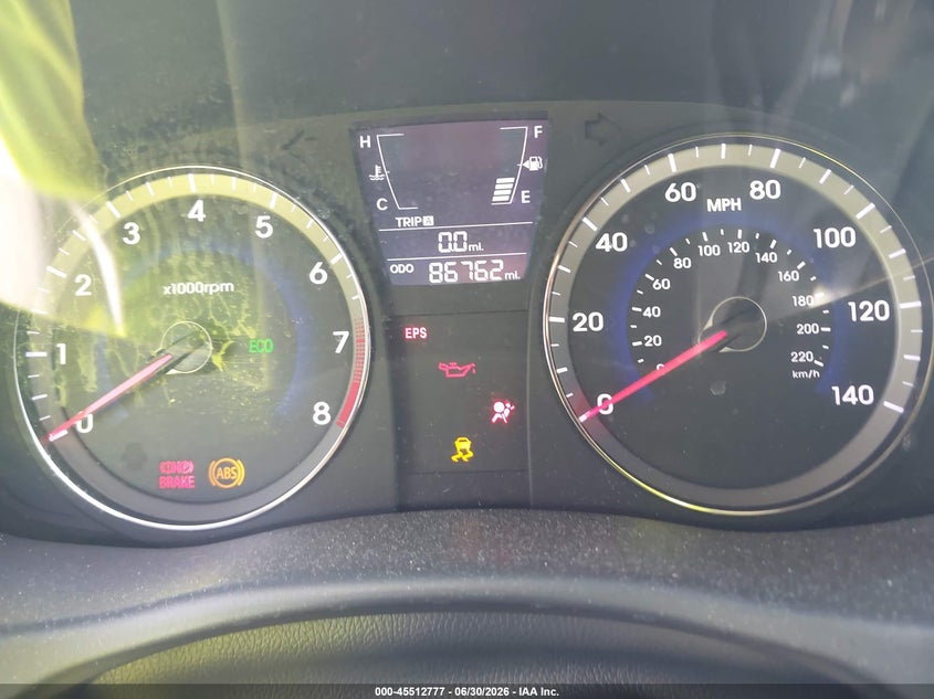 2012 Hyundai Accent VIN KMHCT4AE6CU116107 IAAI salvage auction — FRONT END, Rebuildable (Florida), sold $25 on 2026-07-16 (photo 7)