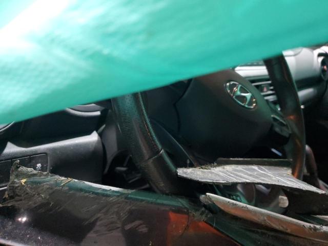 2022 Hyundai Kona VIN KM8K3CA32NU841159 COPART salvage auction — ALL OVER, Co - Bill Of Sale-Parts Only, sold $100 on 2026-07-30 (photo 9)