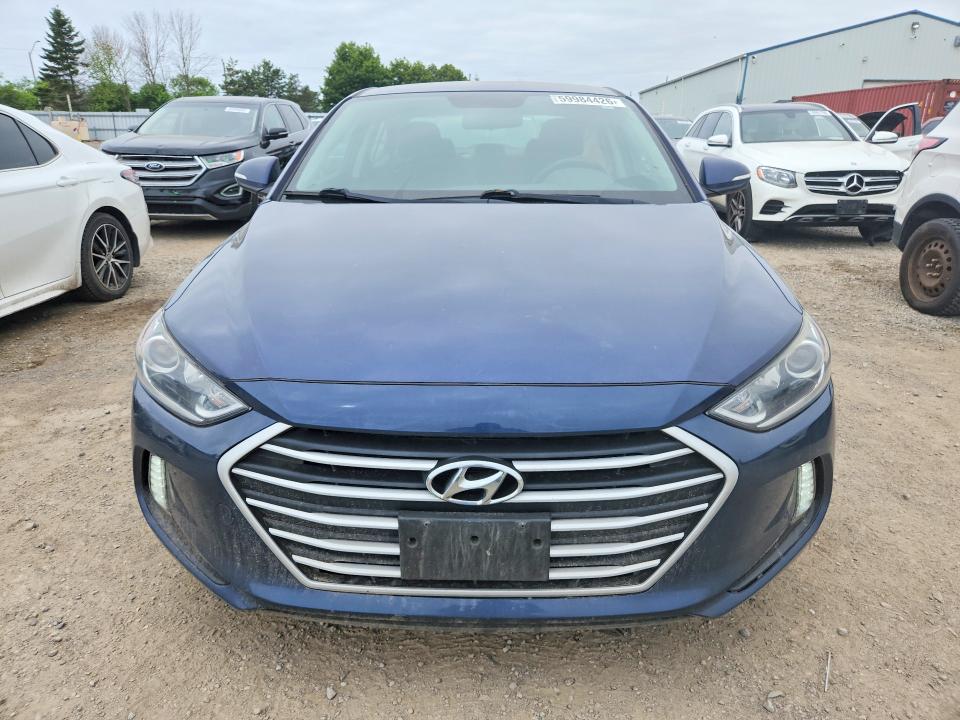 2017 Hyundai Elantra VIN KMHD84LF5HU375724 COPART salvage auction — SIDE, ON - PERMIT NO BRAND - UNFIT, sold $1,750 on 2026-07-28 (photo 5)